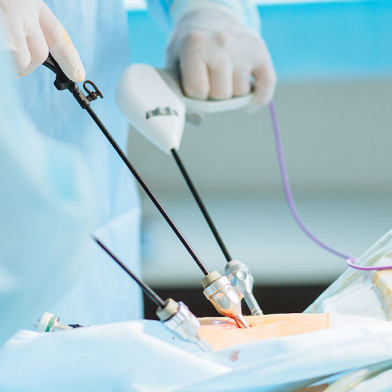 Laparoscopic Surgery